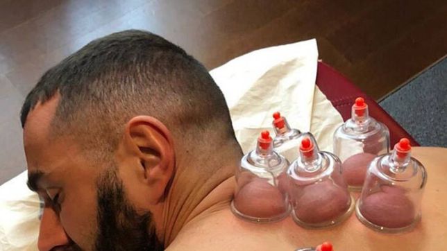 هل يستعد كريم بنزيما لمباراة ليفربول خلال الأيام القادمة بالحجامة