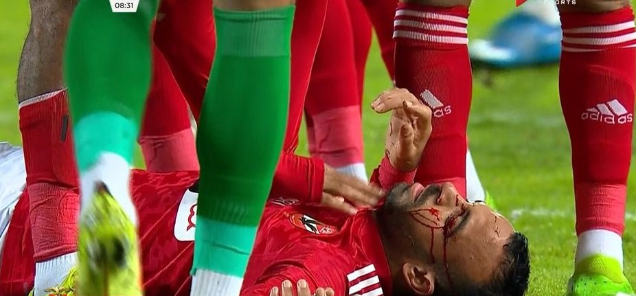إصابة دموية لأفشة في مباراة الأهلي والمصري اليوم بالدوري الممتاز